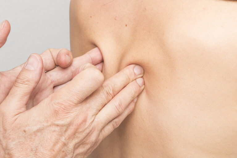 terapi massage ryg fysio
