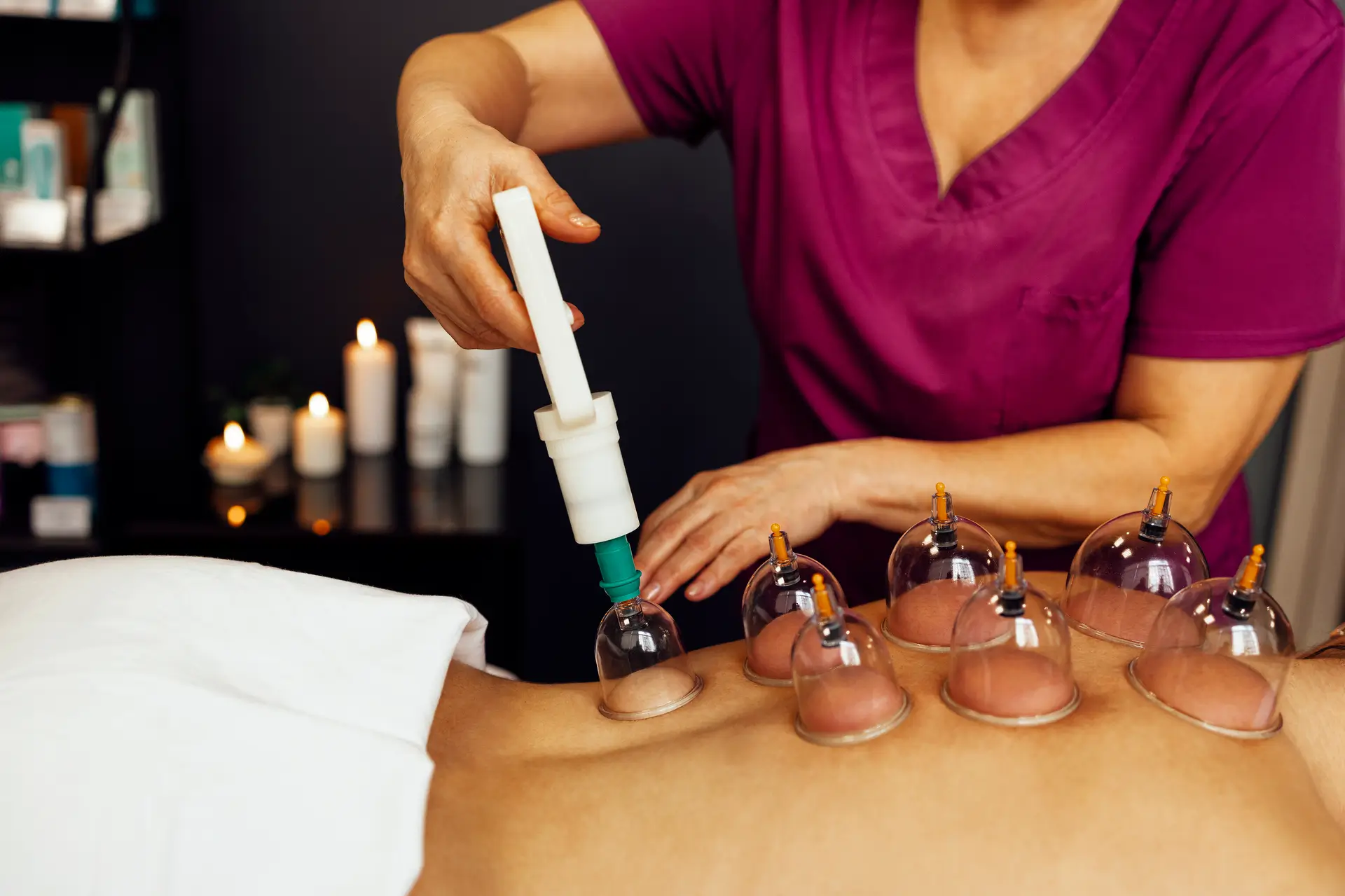 Cupping behandling